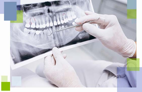 leczenie-kanalowe-dentysta-torun
